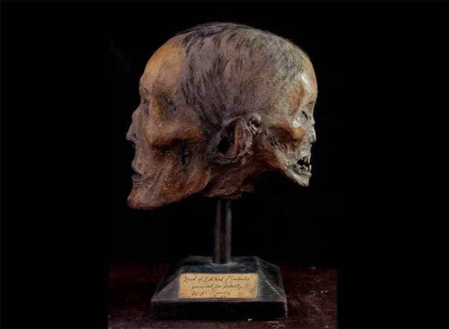 Edward Mordrake mummified head