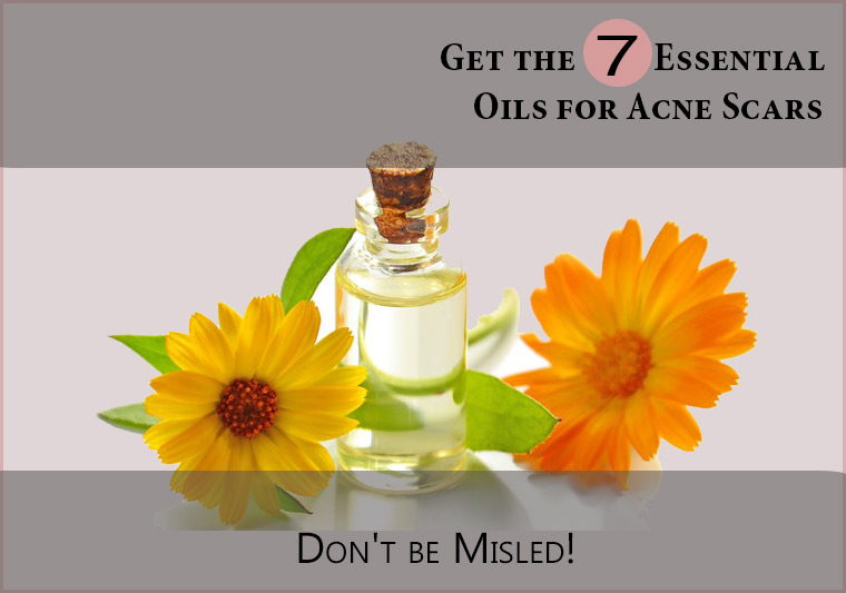 Essential-Oils-for-Acne-Scars